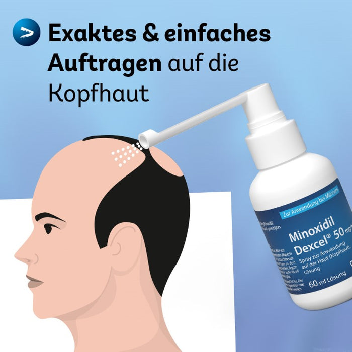 Minoxidil Dexcel 50 mg/ml Spray für Männer zur Anwendung auf der Haut (Kopfhaut), 180 ml Solution