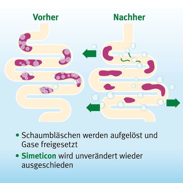 Espumisan Perlen Weichkapseln bei Blähungen und Völlegefühl, 100 pcs. Capsules