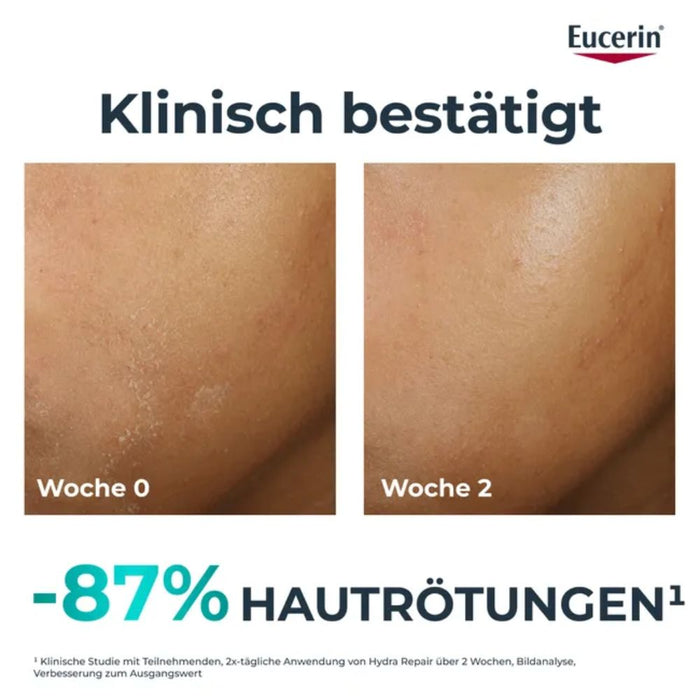Eucerin Dermopure Hydra Repair Feuchtigkeitspflege für zu Akne neigende Haut, 40 ml Creme