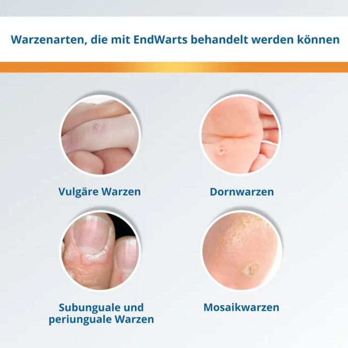 EndWarts PEN F Warzenbehandlung für Hände und Füße, 3 ml Solution
