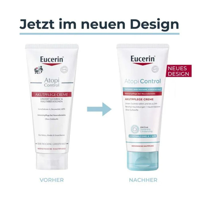 Eucerin AtopiControl Akutpflege Creme reduziert Juckreiz und lindert Rötungen und Hautreizungen, 100 ml Cream