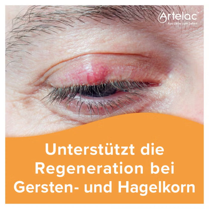 Artelac Augenlidhelfer bei Beschwerden der Augenlider, 15 g Onguent