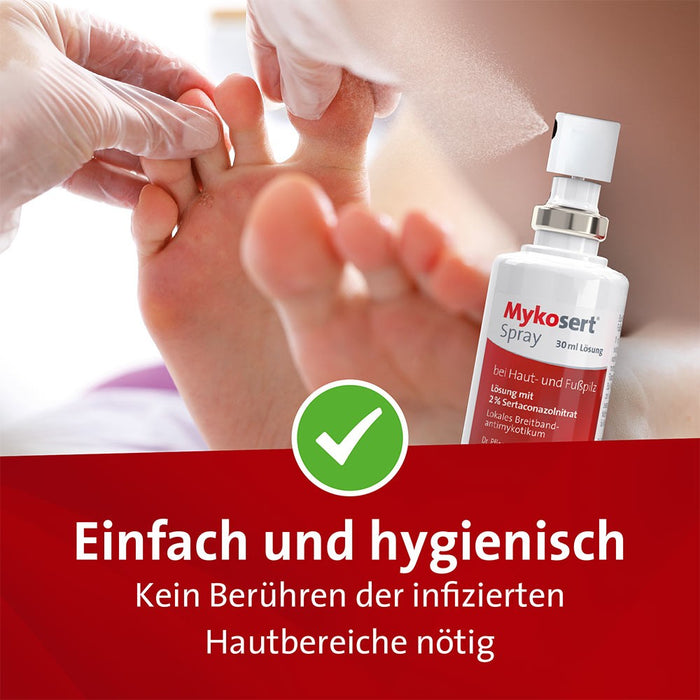 Mykosert Spray bei Haut- und Fußpilz, 60 ml Solution