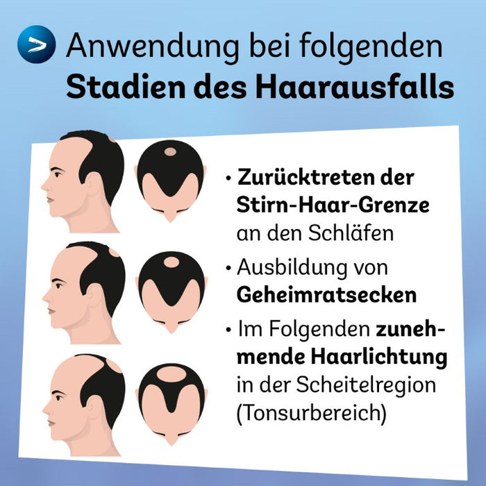 Minoxidil Dexcel 50 mg/ml Spray für Männer zur Anwendung auf der Haut (Kopfhaut), 180 ml Solution